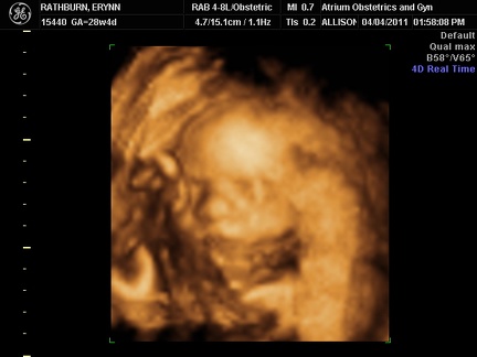 Ultrasound 4April2011d